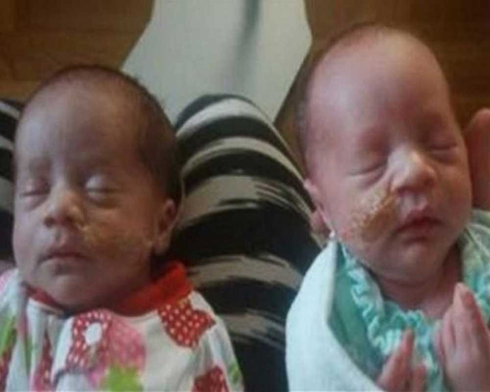 woman gives birth to third set of twins in around 2 years