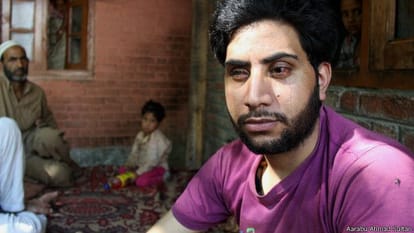 kashmir pellet injury analysis