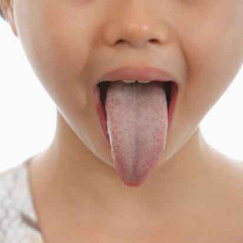 now your tongue say about your health conditions
