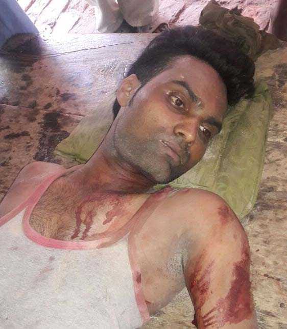 Akbrabad lintel of the houses demolished, the brothers injured