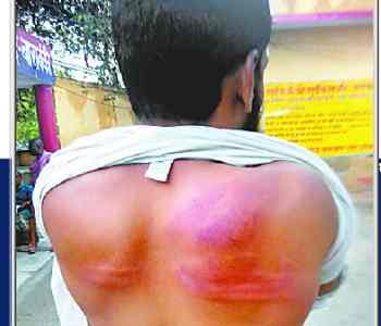 On the complaint of molestation sigh fire on youths