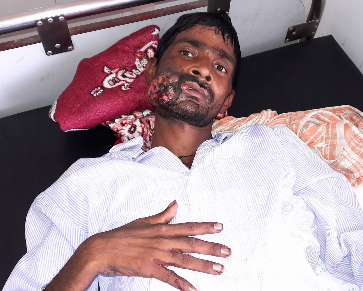help to mouth cancer patient manoj.