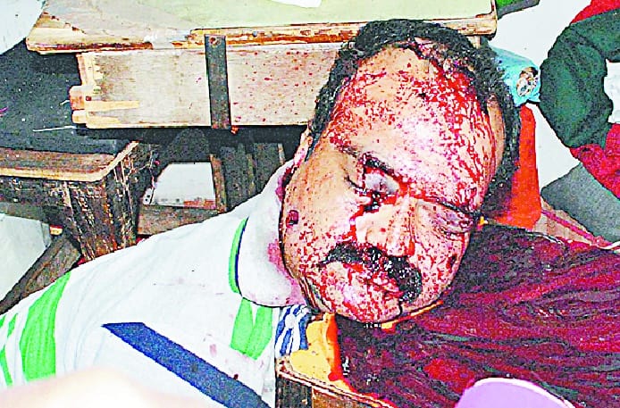 Manoj was five months before prison