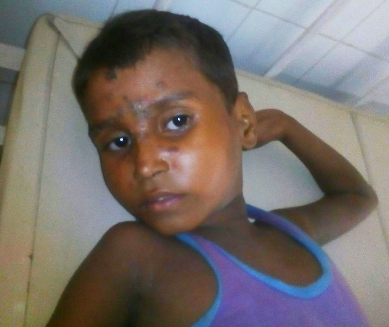 Of diarrhea in hospital Increased number of patients
