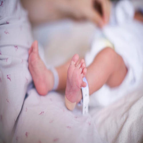 Baby carrying twin fetuses of her siblings
