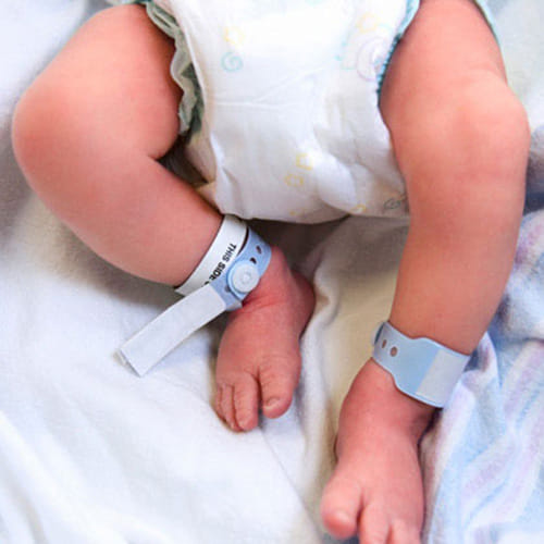 Baby carrying twin fetuses of her siblings