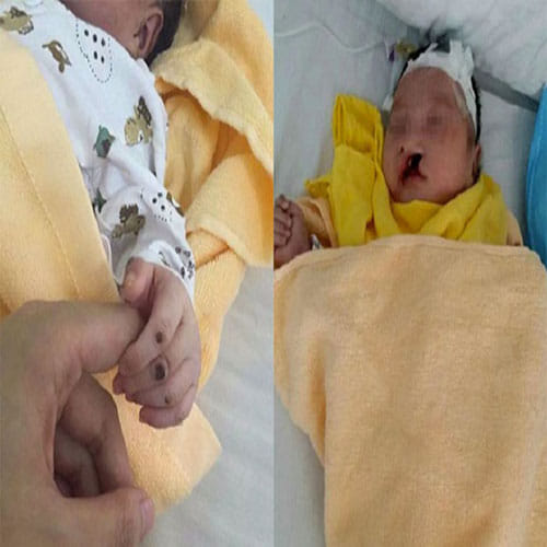 baby found alive after being buried for 8 days