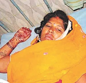 School bus pick-up from the collision of a turnaround , 12 injured Kanvdia