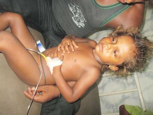 Electrified wire break Scorching falling child
