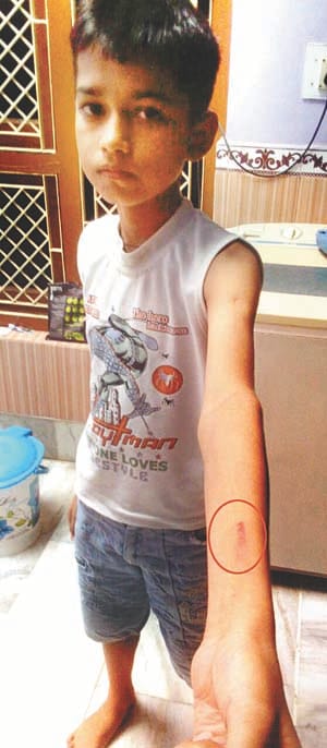 rod se masoom ko peeta