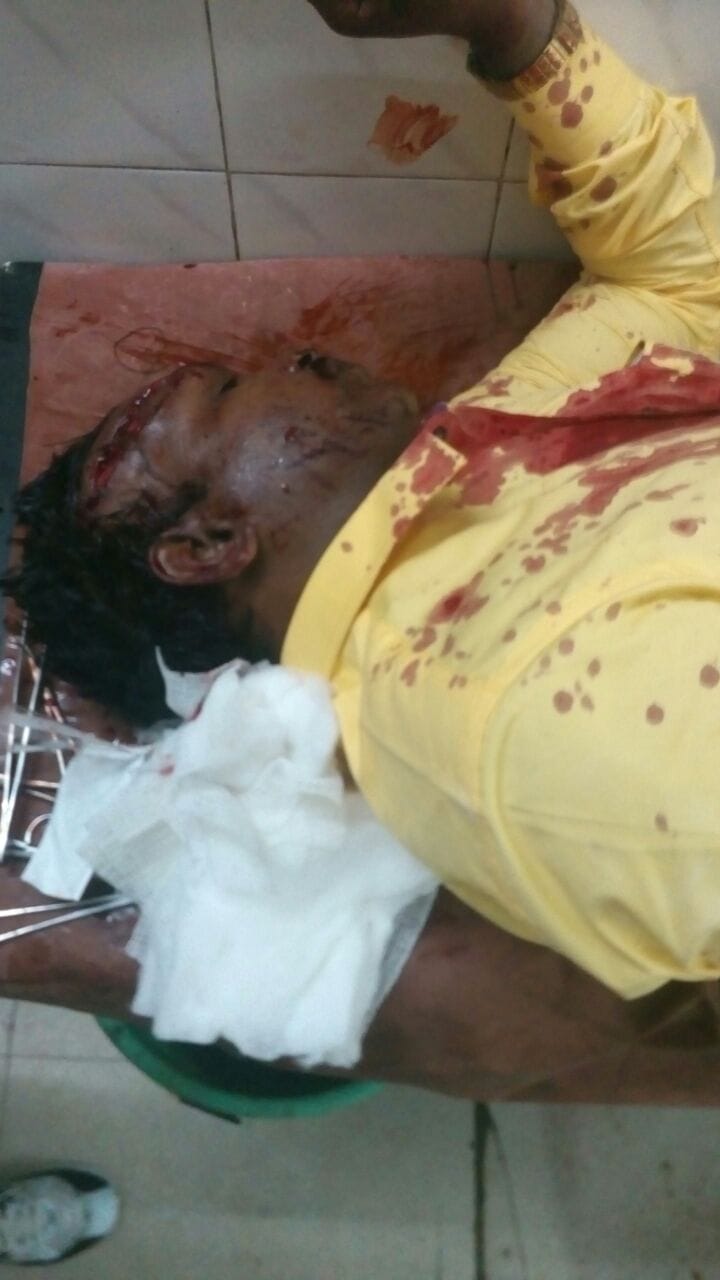 Bus passenger shot on opposing loot 