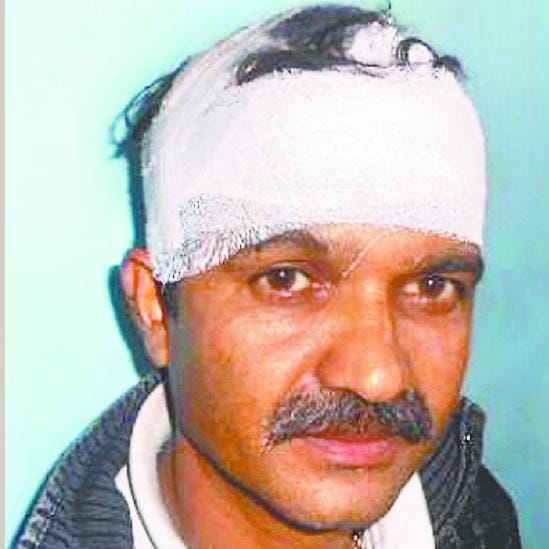 Stone, who suffered head