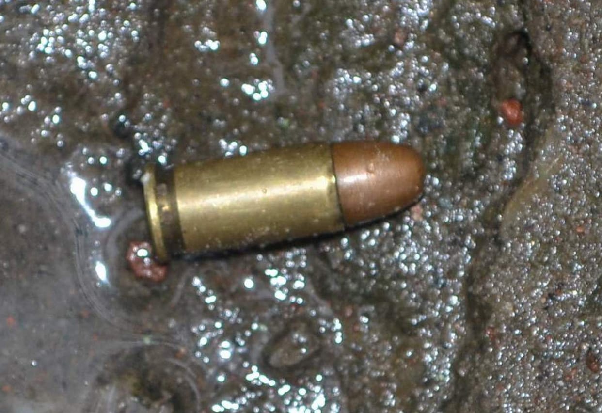 injured with bullet