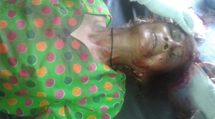 bike truck accident in lucknow bkt area