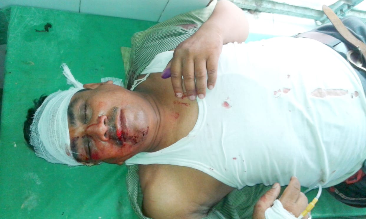 Accountant shot, 1.35 lakh looted from wife