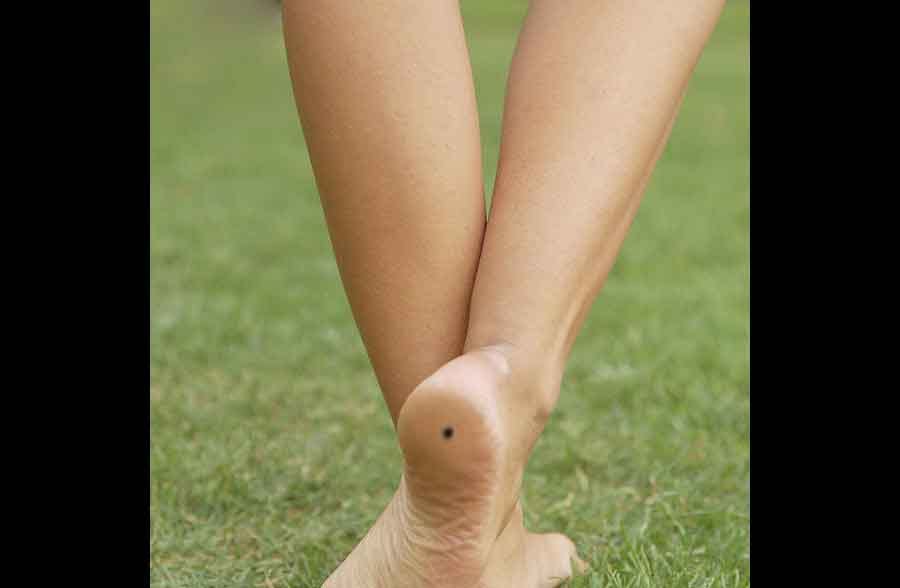meaning of mole on different body parts