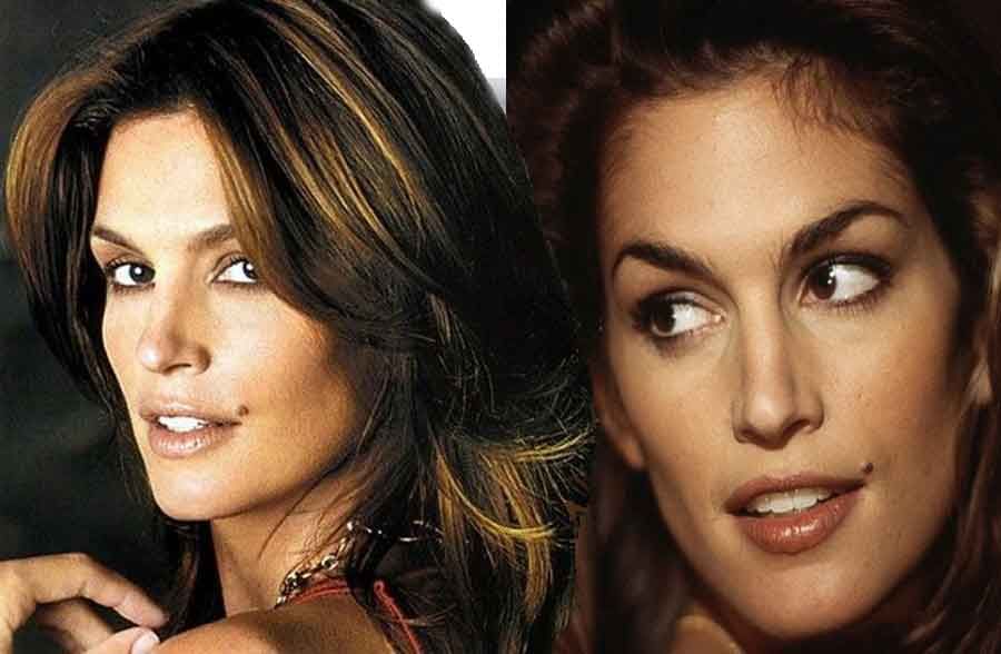 आपके इन 12 अंगों पर मौजूद तिल के निशान का मतलब है, 'बनेंगे अमीर करेंगे