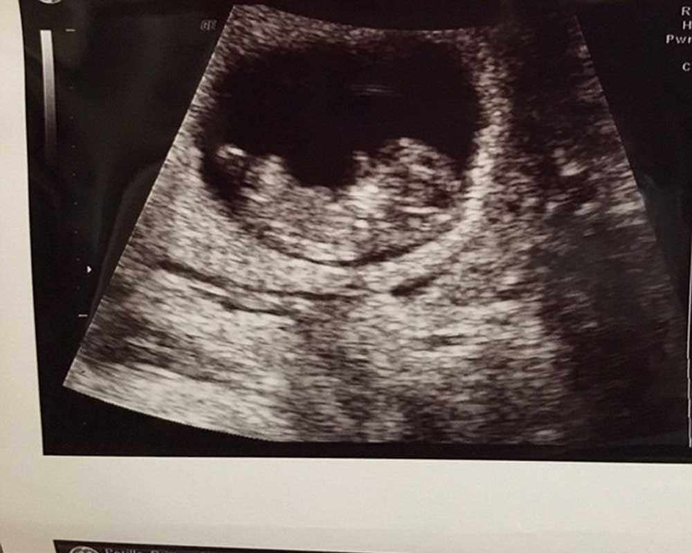 'world's most perfect butt girl'  is three months pregnant