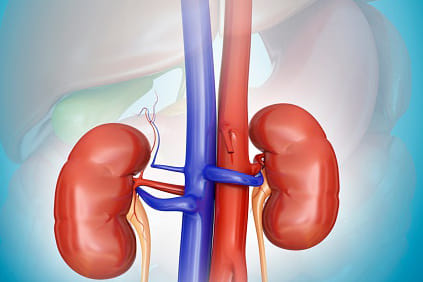 HOW TO TREAT KIDNEY STONES 
