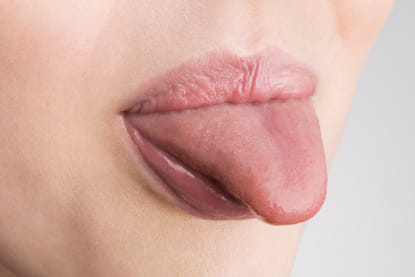 home remedies for tongue