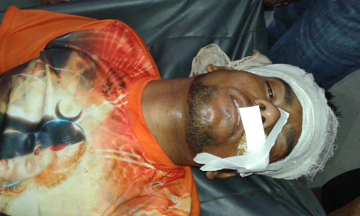 kanwarya wounded, driver out of reach