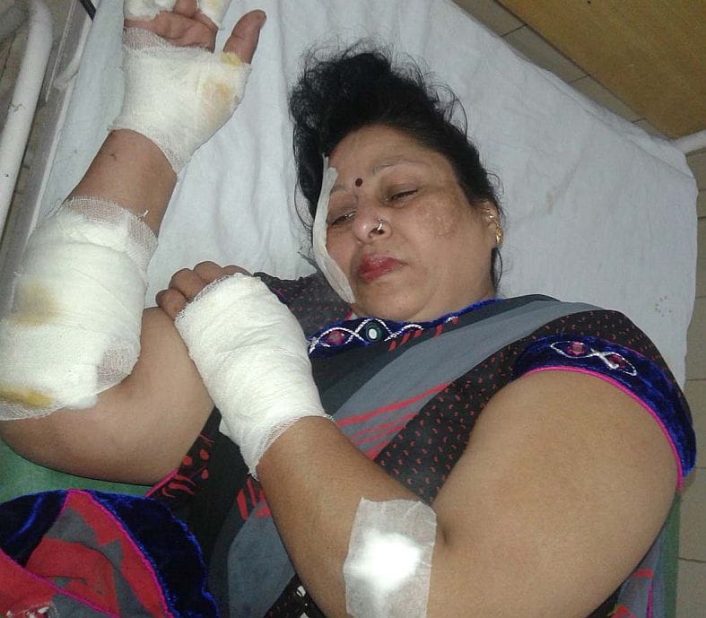 Female clashed with highway robbers.