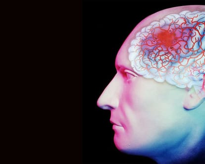world brain stroke day, too little and too much sleep injurious for health