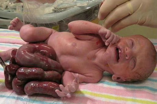 baby born with his organs outside his body 