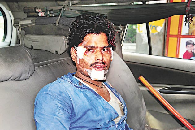 Bravery shown by the dairy operator, the chain Snatcher arrested