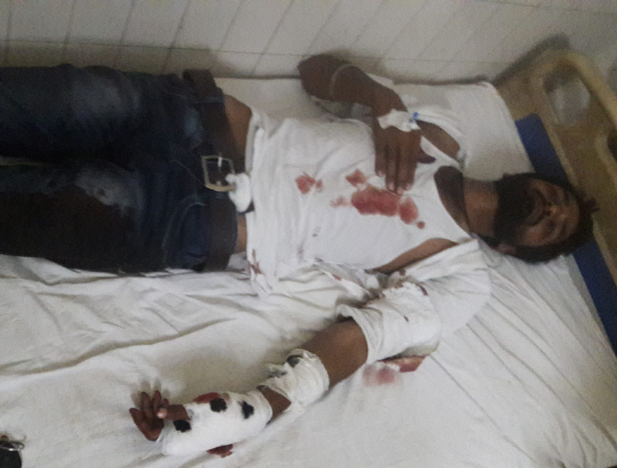 Firing in open market, one injured