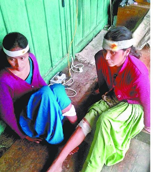 footbridge break, two girl injured