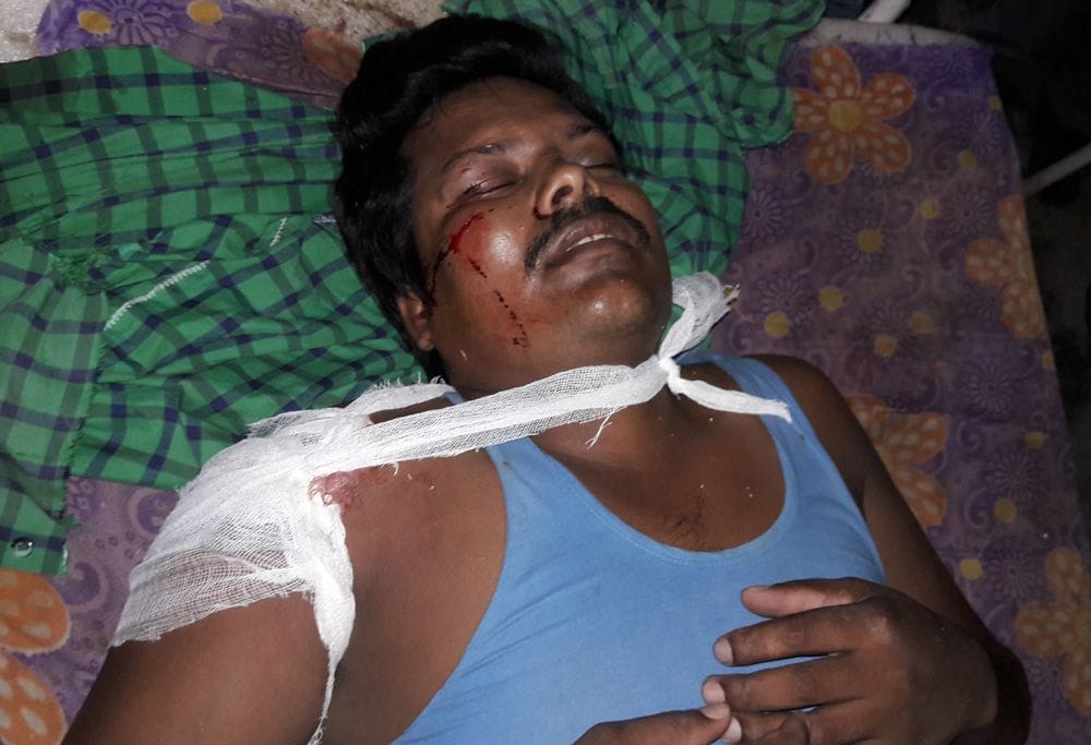 accident on highway, two injured