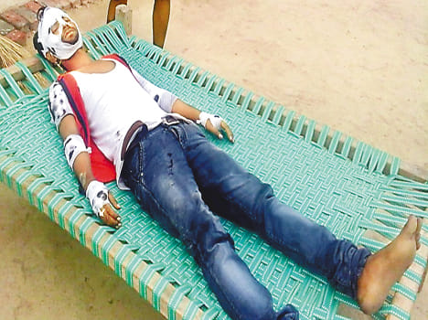 Nilgayon bike collided, youth injured