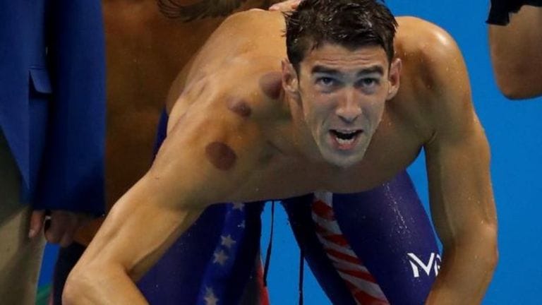 why olympians have big red circles all over the skin