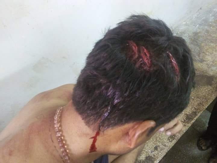 The two sides firing, three injured