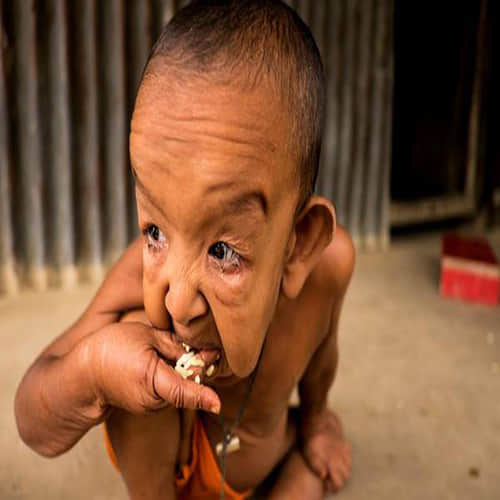 4 Year Old Boy trapped in the body of an old man