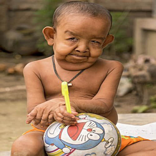 4 Year Old Boy trapped in the body of an old man