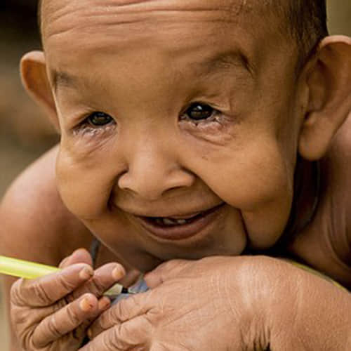 4 Year Old Boy trapped in the body of an old man