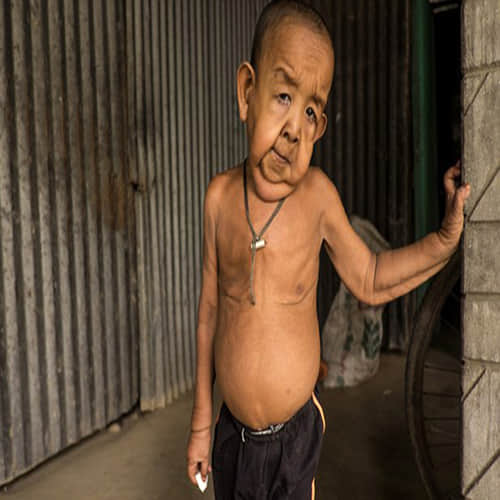 4 Year Old Boy trapped in the body of an old man