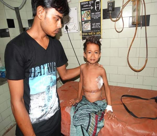 rare kidney tumor operation by kgmu doctors