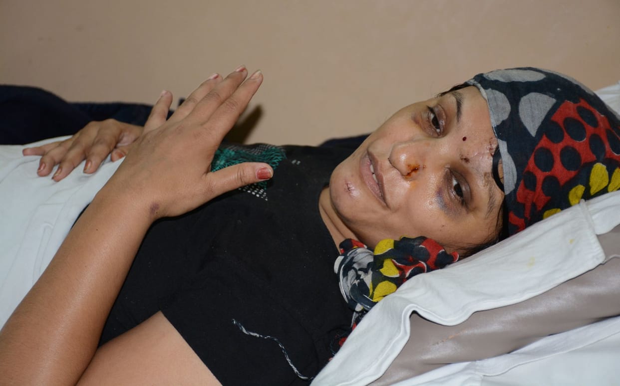  Mock  drill accident administration forgot Shraddha