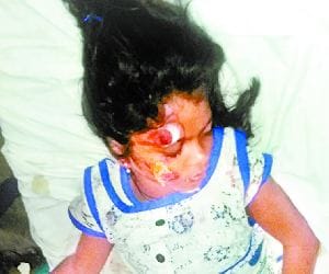 Minister's motorcade car collision serious child