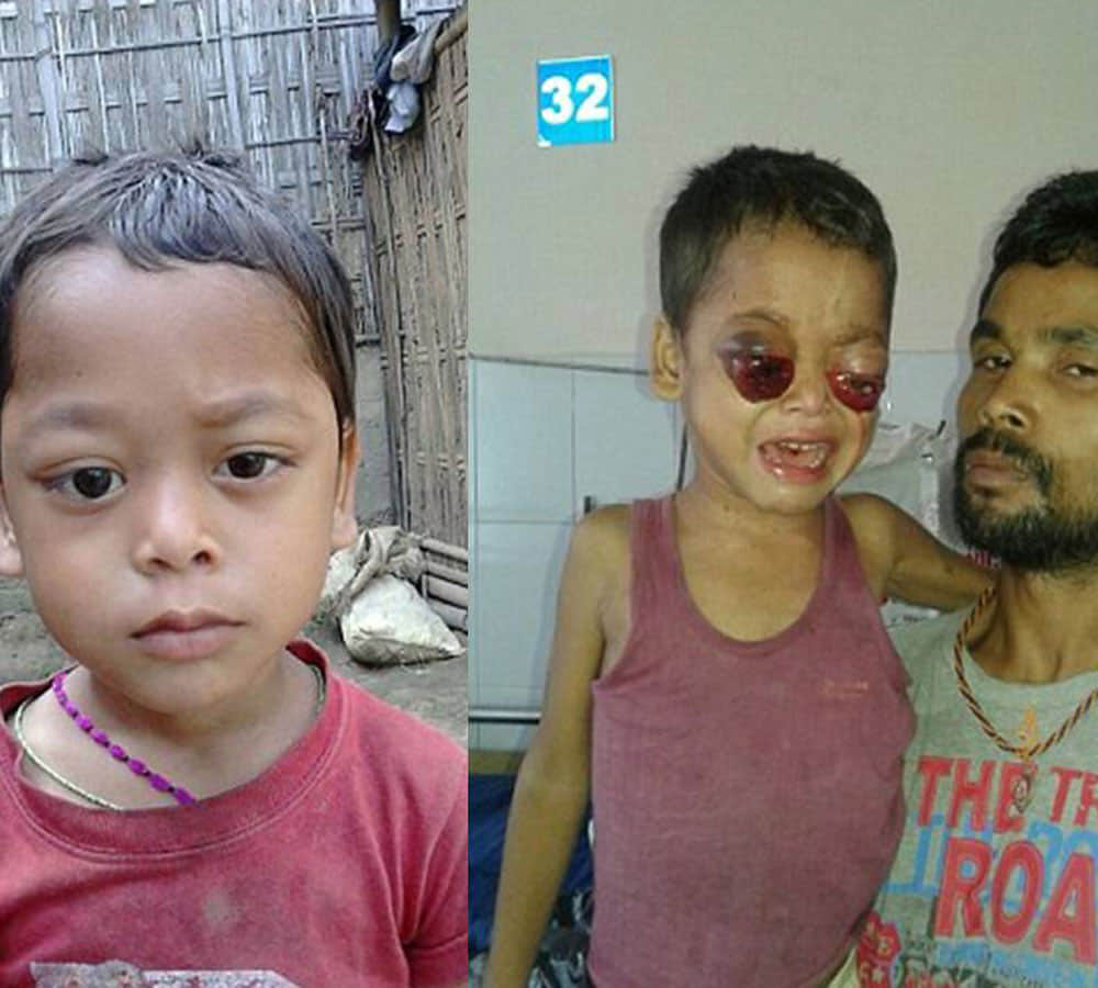 little boy eyes bleed and pop out doctors baffled