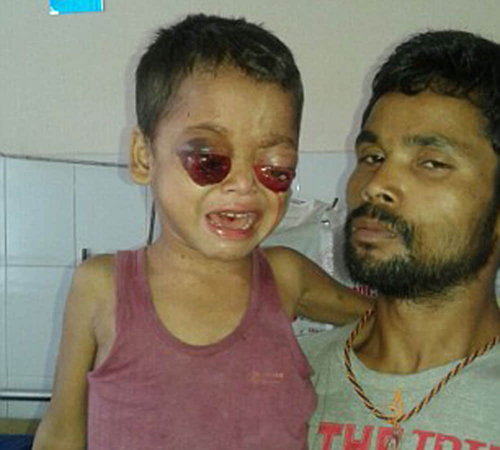 little boy eyes bleed and pop out doctors baffled
