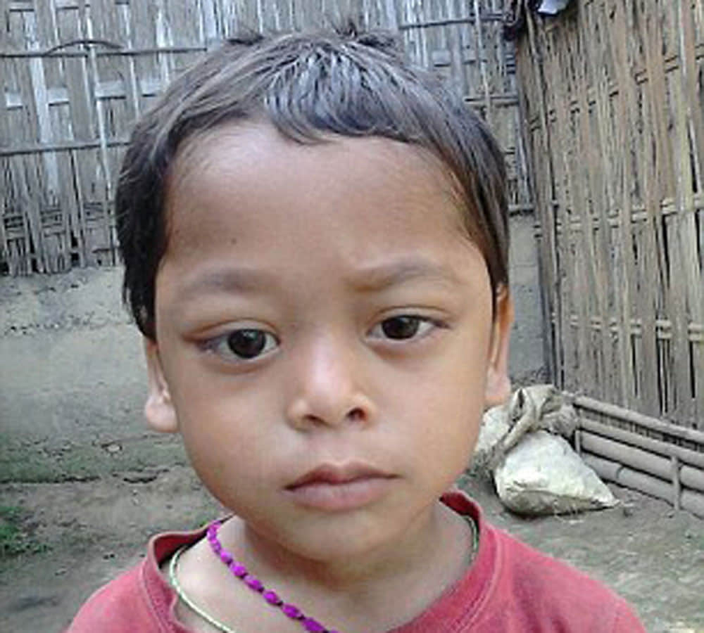 little boy eyes bleed and pop out doctors baffled