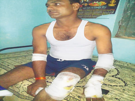 Post-charge injured, did not send helmets