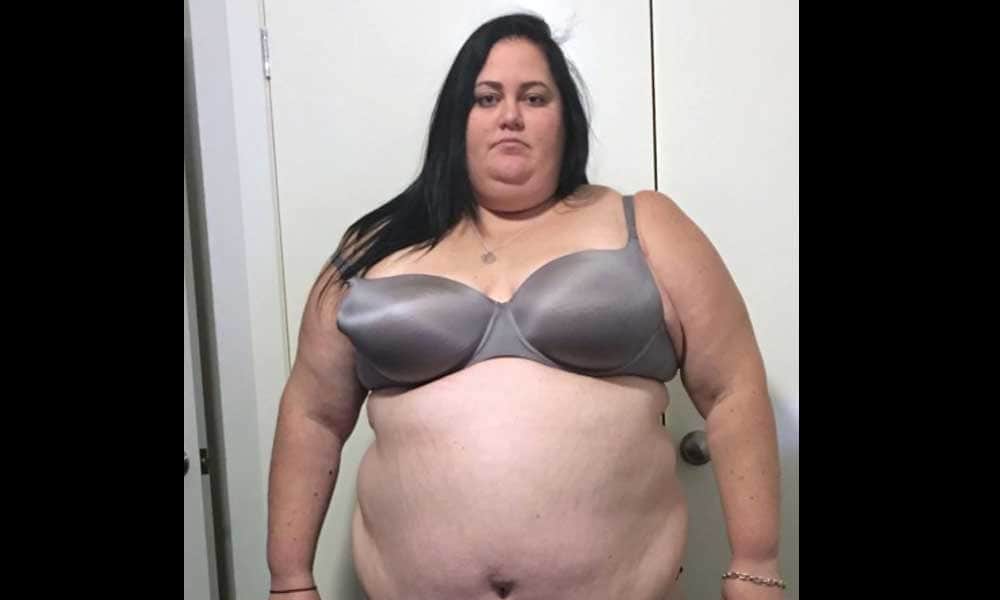 Woman Become Balloon Due To Eating Burgers