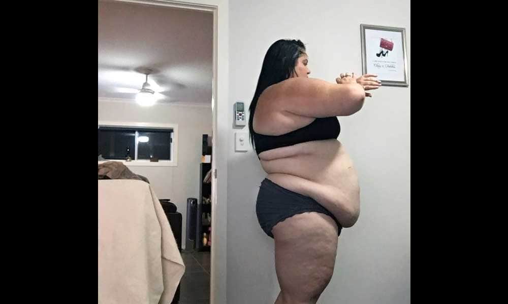 Woman Become Balloon Due To Eating Burgers