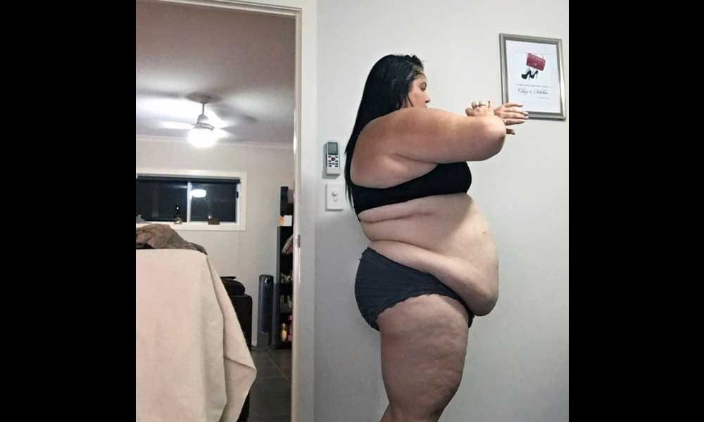 Woman Become Balloon Due To Eating Burgers