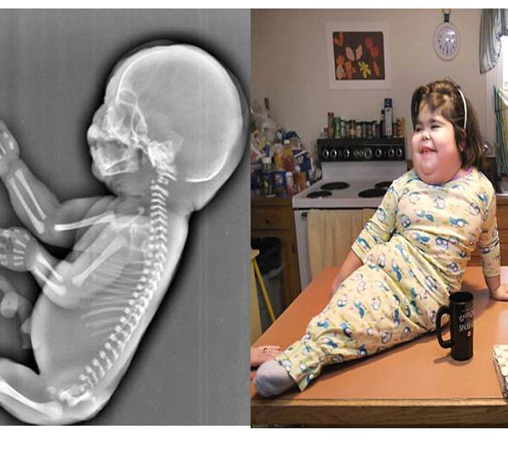 mother found mermaid child after 6 months